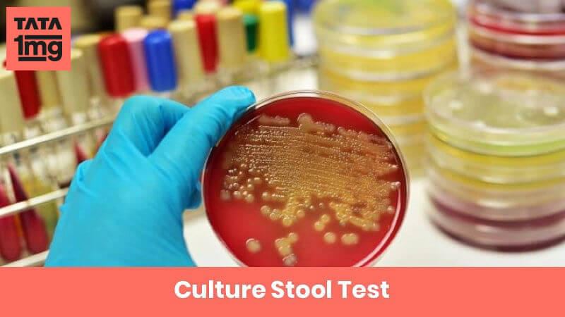 Culture Stool